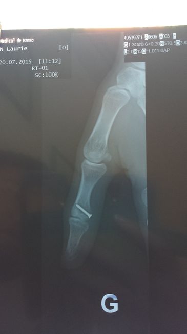 Injured on honeymoon, prayers please! ***UPDATE #2***