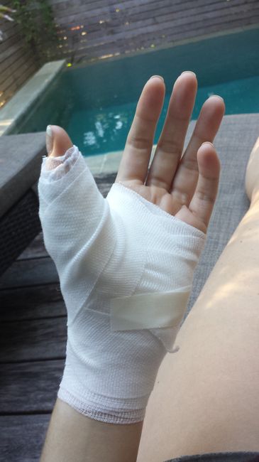 Injured on honeymoon, prayers please! ***UPDATE #2***