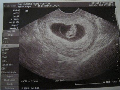 Just got our first ultrasound this morning!!!!