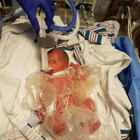 Thoughts, prayers, well wishes (update with photo <3 )