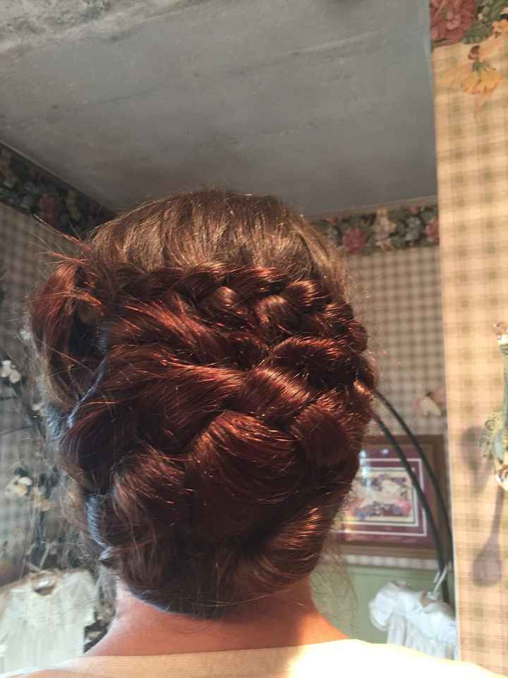 Hair Problems