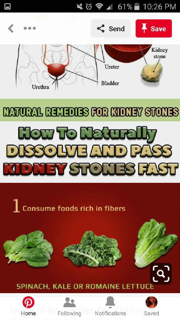 Stress and Stones - 1