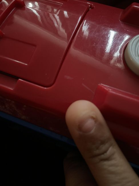 My Finger Nail Fell Off 1 Month Before my Wedding!!! - 1