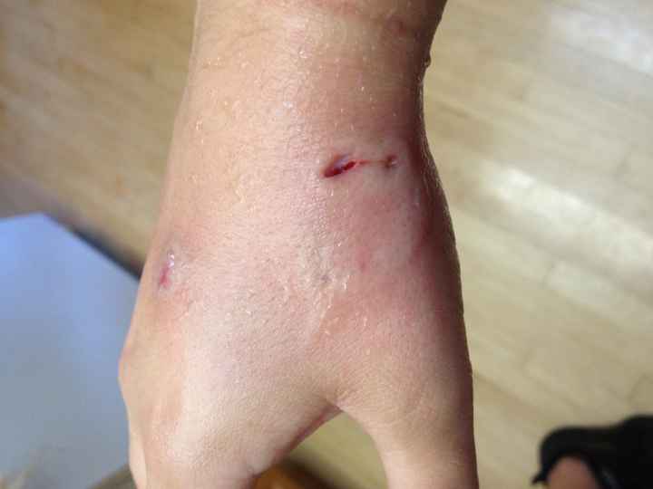 NWR Rough night I got a really bad owie