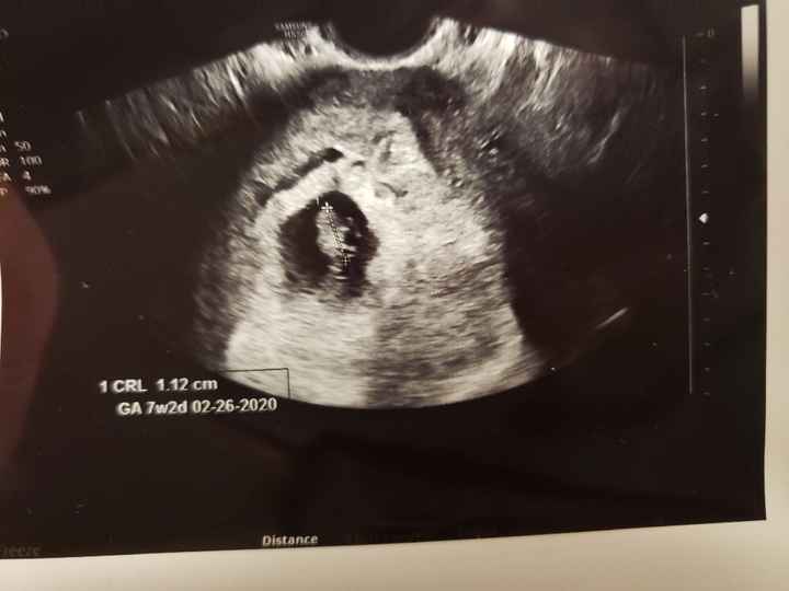 Loving Married life! - 1