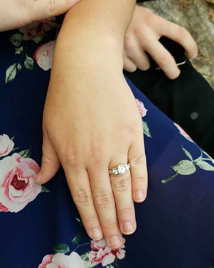 Engagement Rings: Expectation vs. Reality! - 1