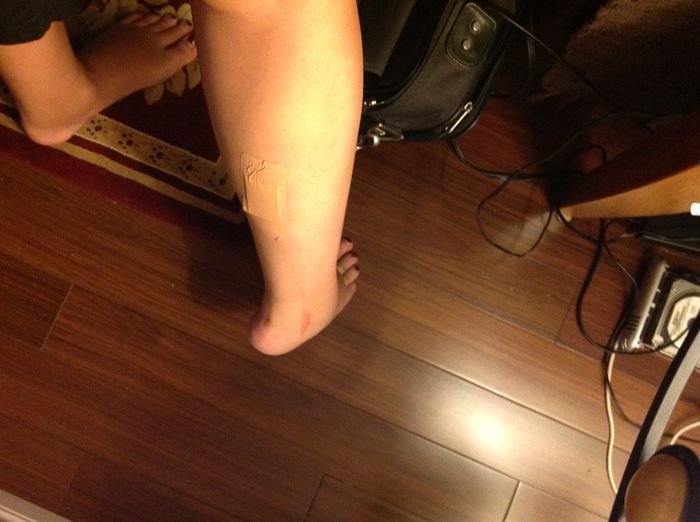Crafting injury :( but........