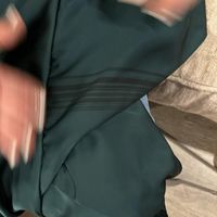 Polyester Dress suddenly getting stripes - 1