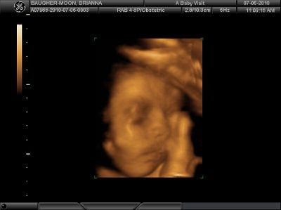 4D Ultrasound (Pic Heavy) NWR