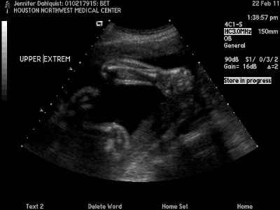 Update, a little BR stuff and a huge thank you.