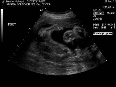 Update, a little BR stuff and a huge thank you.