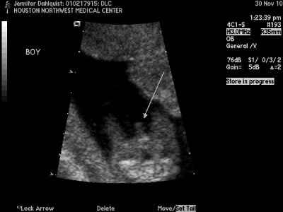 BR:  The gender is in the envelope!