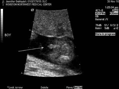 BR:  The gender is in the envelope!