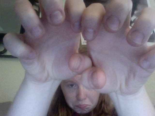 nail biters...unite