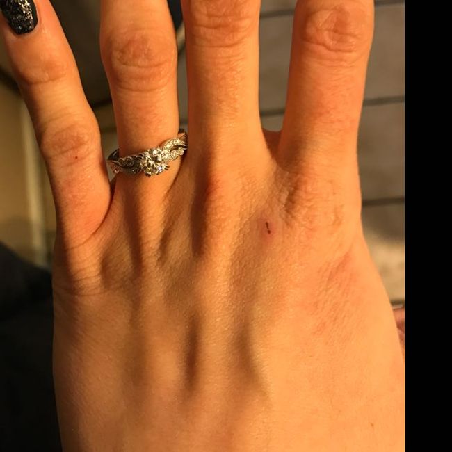 Ring scratched!! 1
