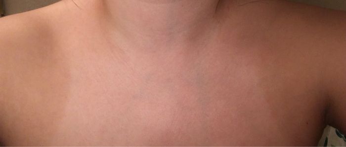 Spray tan 5 days before wedding? 1