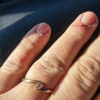 Anyone get crap for the size of their engagement ring?