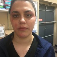 So scared, but keeping hope!