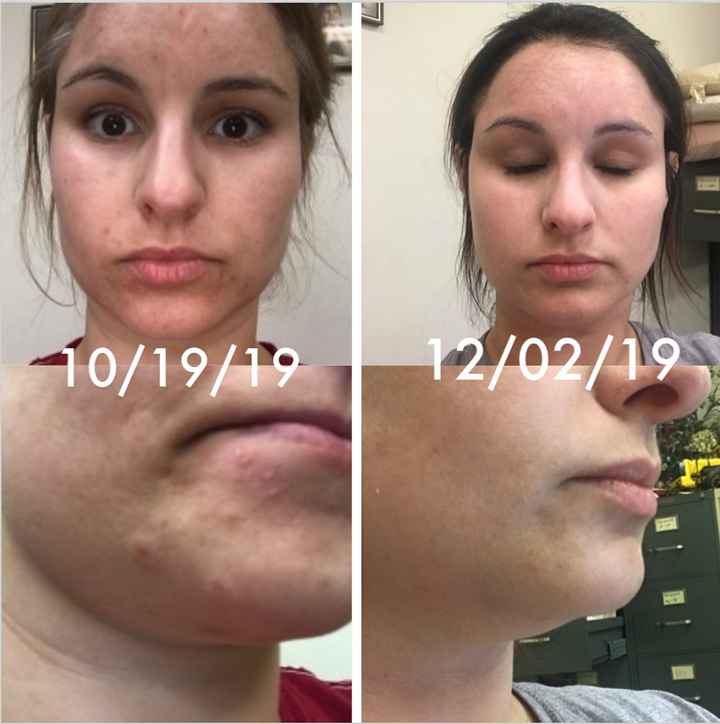 Need skincare advice... - 1