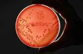 lets see your STD's!!!