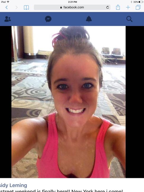 Tinea Versicolor... 1