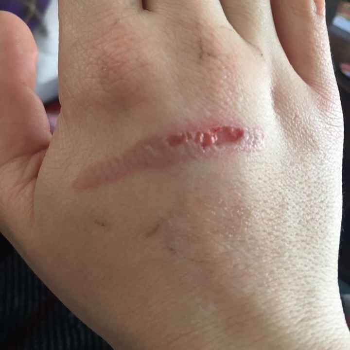 Ugly digits.