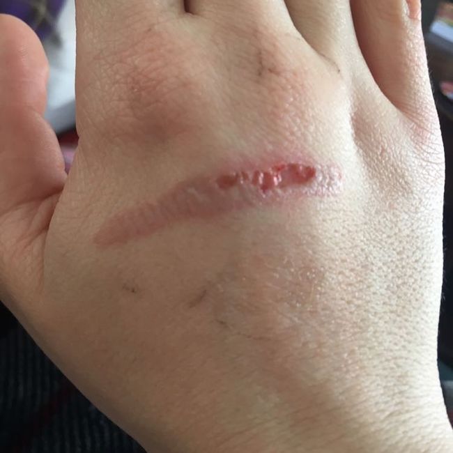 Ugly digits.