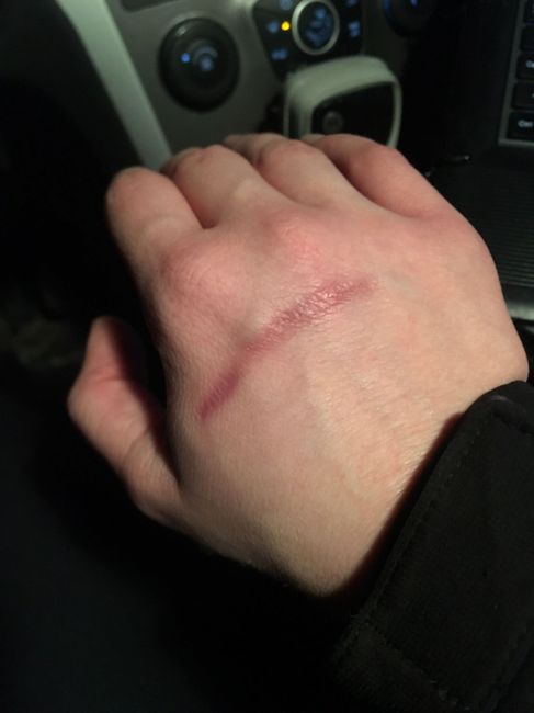 Ugly digits.