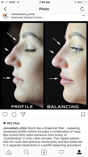NWR: Nose Job