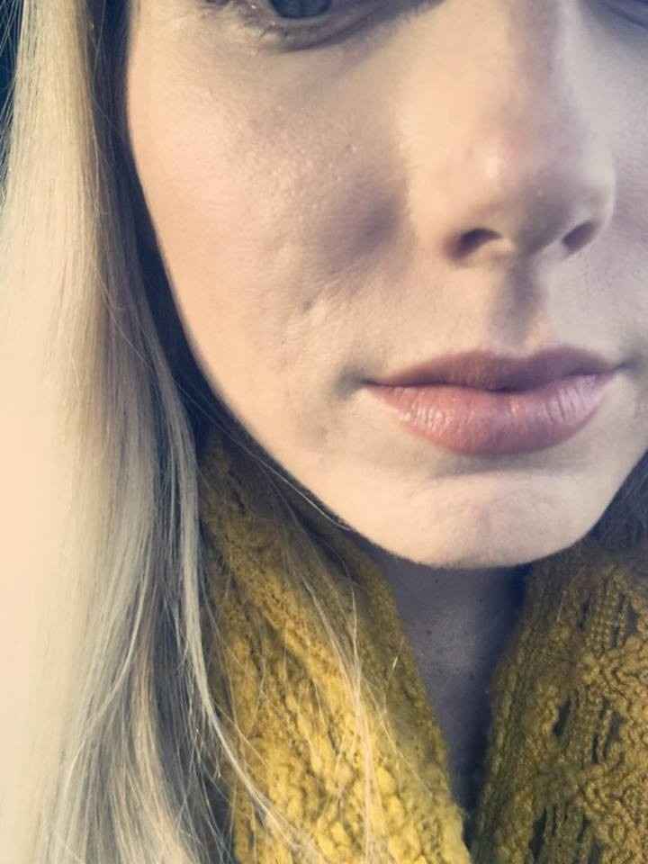 Skin Journey  &  need cosmetology procedure advice