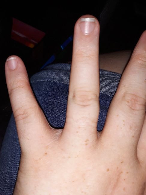 Is my engagement ring too tight? 3