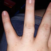 Is my engagement ring too tight? - 3