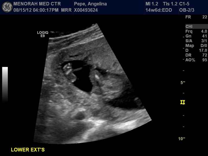6 months pregnant..We are having a.... *PICS included!!*