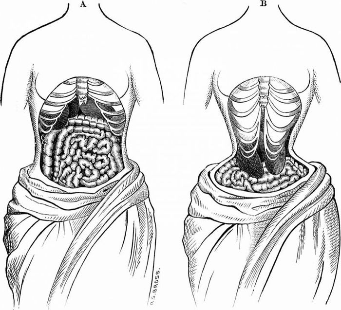 Waist trainers