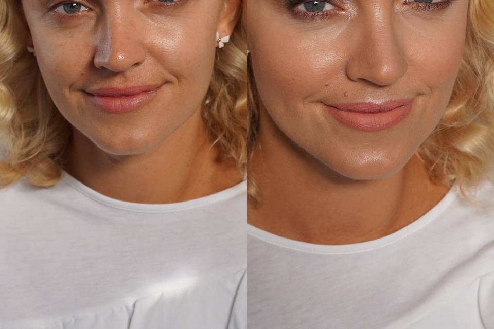 Before/After