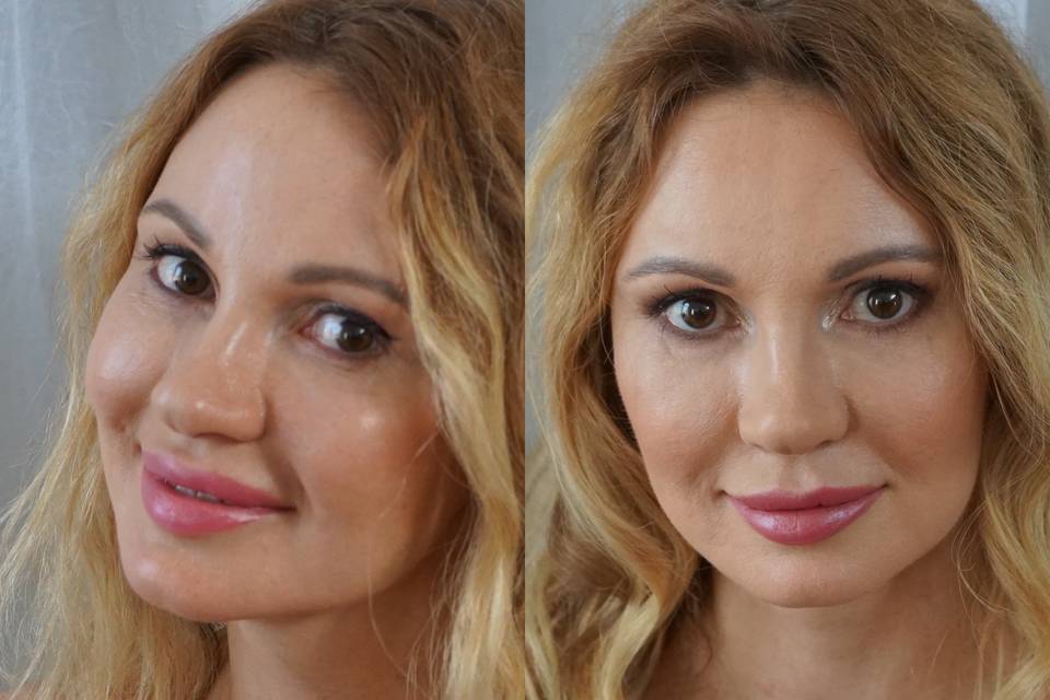Before/After