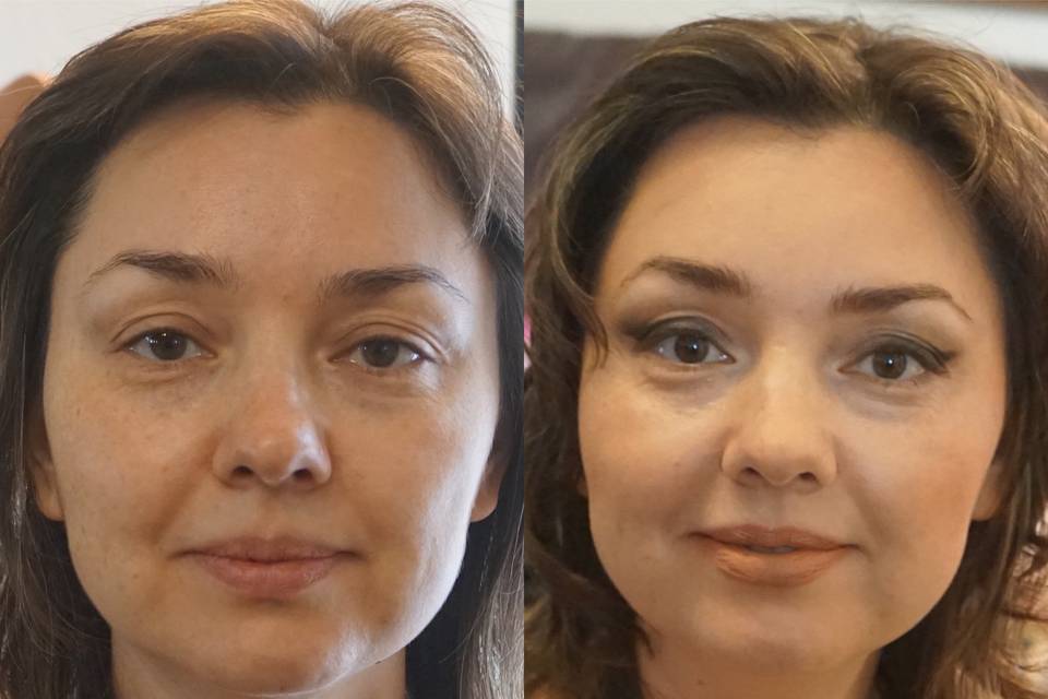 Before/After