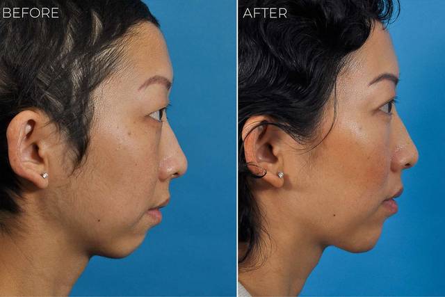 Ponsky Facial Plastic Surgery