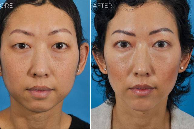 Ponsky Facial Plastic Surgery