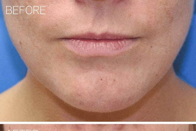 Ponsky Facial Plastic Surgery