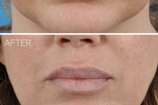 Ponsky Facial Plastic Surgery