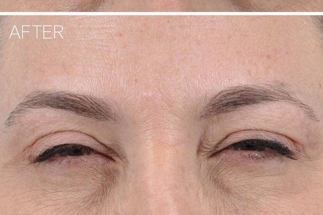 Ponsky Facial Plastic Surgery