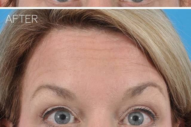 Ponsky Facial Plastic Surgery