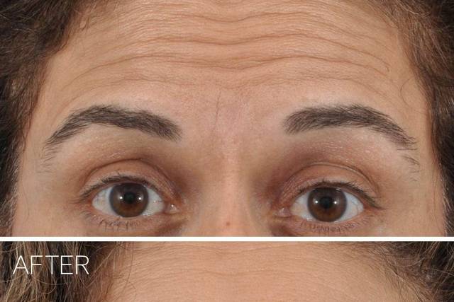 Ponsky Facial Plastic Surgery