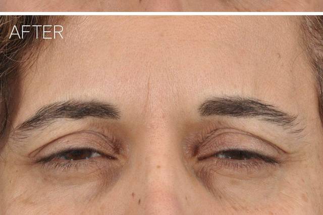 Ponsky Facial Plastic Surgery