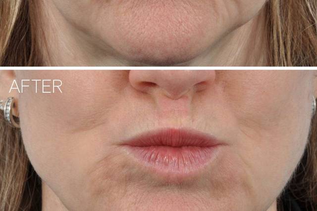 Ponsky Facial Plastic Surgery