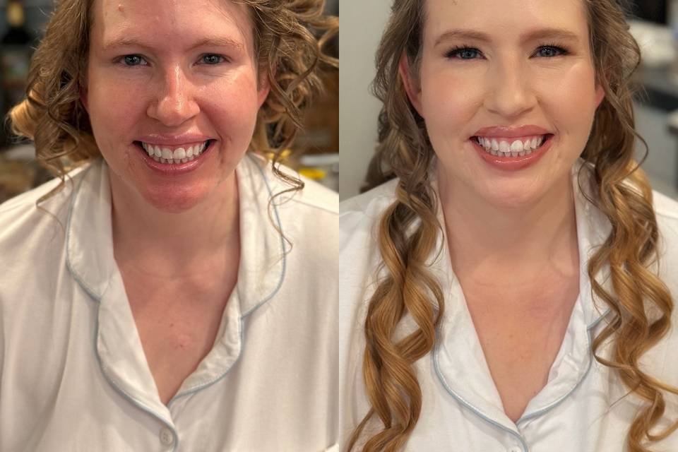 Before and after
