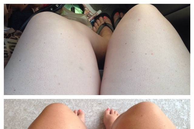 Darker skin