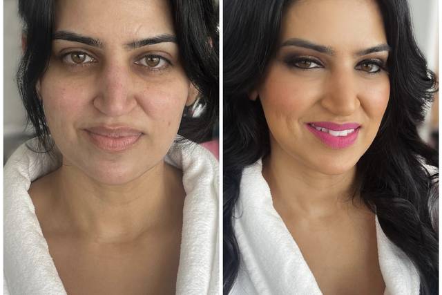 Before/After