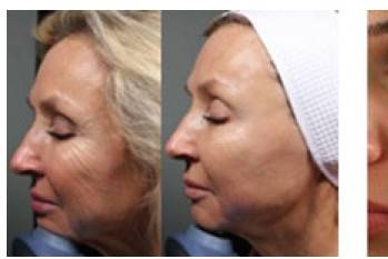Great results